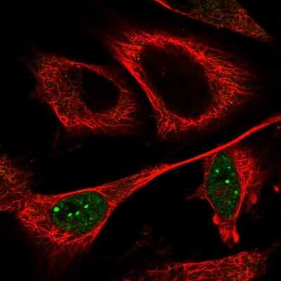 Immunocytochemistry/ Immunofluorescence: CCDC102A Antibody [NBP1-82766]