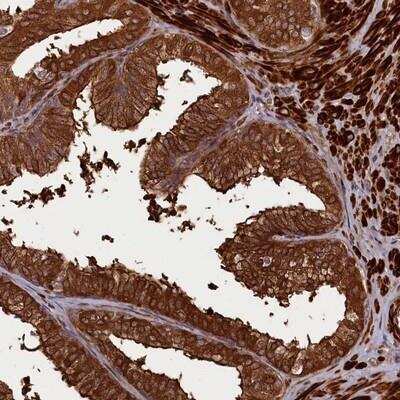 Immunohistochemistry-Paraffin: CCDC102A Antibody [NBP1-82765]