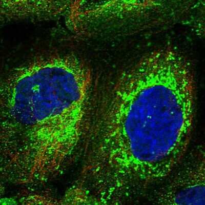 Immunocytochemistry/ Immunofluorescence: CCDC102B Antibody [NBP1-89260]