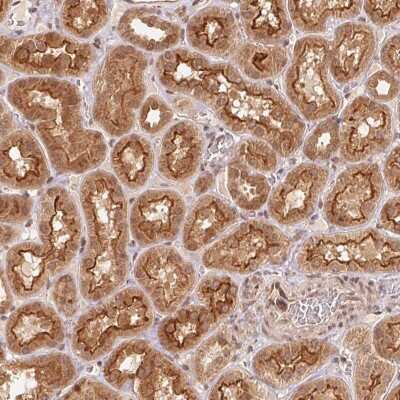 Immunohistochemistry: CCDC102B Antibody [NBP2-38575]