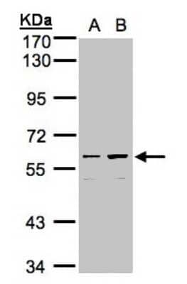 Western Blot: CCDC102B Antibody [NBP1-32619]