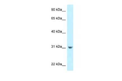 Western Blot: CCDC102B Antibody [NBP2-87139]