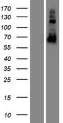 Western Blot: CCDC102B Overexpression Lysate [NBP2-08331]