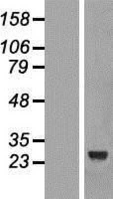 Western Blot: CCDC103 Overexpression Lysate [NBL1-08761]