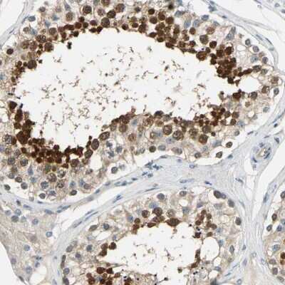 Immunohistochemistry-Paraffin: CCDC104 Antibody [NBP1-93513]