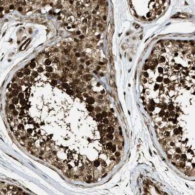 Immunohistochemistry-Paraffin: CCDC104 Antibody [NBP1-93514]