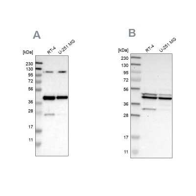 Western Blot: CCDC104 Antibody [NBP1-93514]