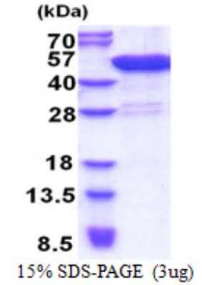 SDS-PAGE: Recombinant Human CCDC104 His Protein [NBP2-22787]