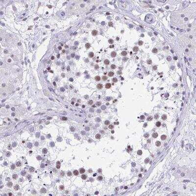 Immunohistochemistry-Paraffin: CCDC105 Antibody [NBP2-32391]