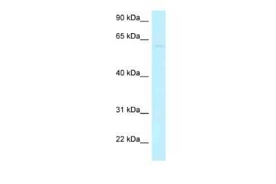 Western Blot: CCDC105 Antibody [NBP2-83000]