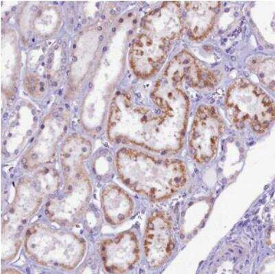 Immunohistochemistry: CCDC106 Antibody [NBP2-30542]