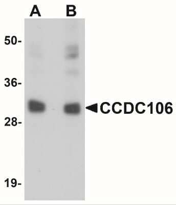 Western Blot: CCDC106 AntibodyBSA Free [NBP1-77381]