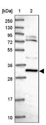 Western Blot: CCDC106 Antibody [NBP2-30390]