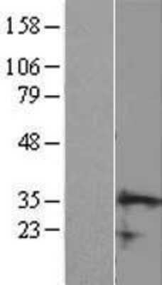 Western Blot: CCDC106 Overexpression Lysate [NBL1-08762]