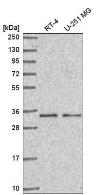 Western Blot: CCDC107 Antibody [NBP2-58785]