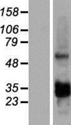 Western Blot: CCDC107 Overexpression Lysate [NBP2-05100]