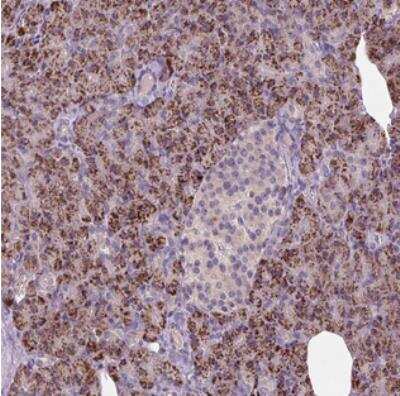 Immunohistochemistry: CCDC108 Antibody [NBP2-30989]