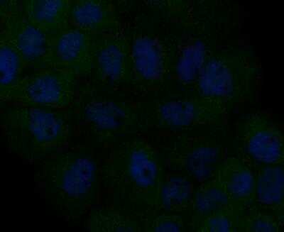 Immunocytochemistry/ Immunofluorescence: CCDC109A Antibody [NBP2-76948]