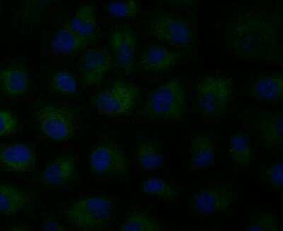 Immunocytochemistry/ Immunofluorescence: CCDC109A Antibody [NBP2-76948]