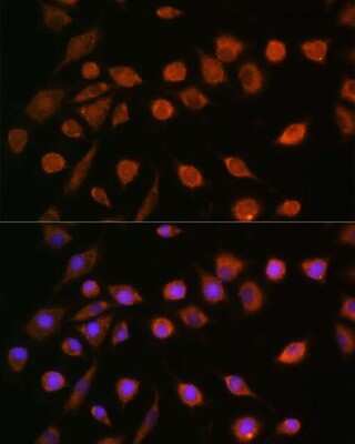 Immunocytochemistry/ Immunofluorescence: CCDC109A Antibody - Azide and BSA Free [NBP2-92310]