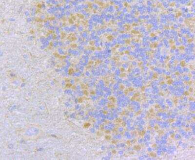 Immunohistochemistry: CCDC109A Antibody [NBP2-76948]