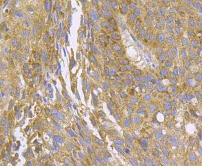 Immunohistochemistry: CCDC109A Antibody [NBP2-76948]