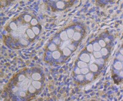 Immunohistochemistry: CCDC109A Antibody [NBP2-76948]