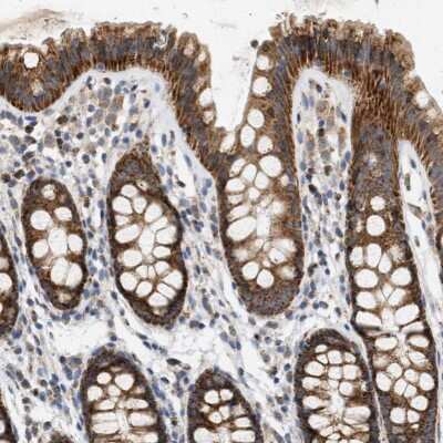 Immunohistochemistry-Paraffin: CCDC109A Antibody [NBP1-88534]