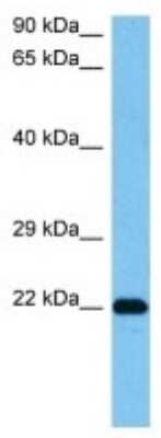 Western Blot: CCDC109A Antibody [NBP3-10845]