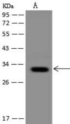 Western Blot: CCDC109A Antibody [NBP3-12716]