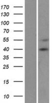 Western Blot: CCDC109A Overexpression Lysate [NBP2-05662]