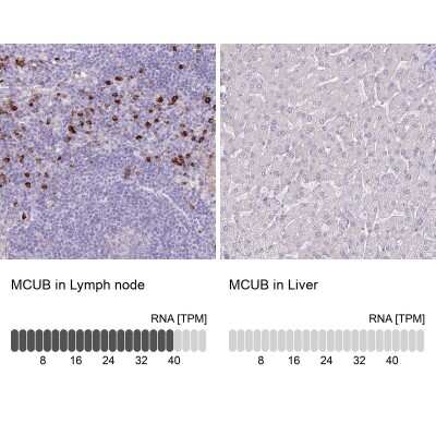 Immunohistochemistry-Paraffin: CCDC109B Antibody [NBP2-14657]