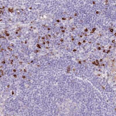 Immunohistochemistry-Paraffin: CCDC109B Antibody [NBP2-14657]