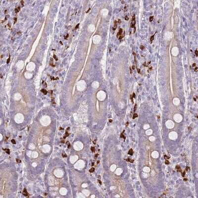 Immunohistochemistry-Paraffin: CCDC109B Antibody [NBP2-14657]