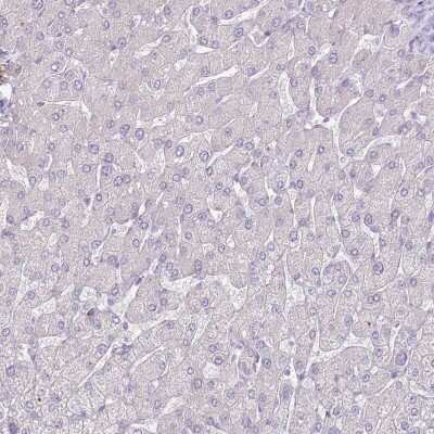 Immunohistochemistry-Paraffin: CCDC109B Antibody [NBP2-14657]