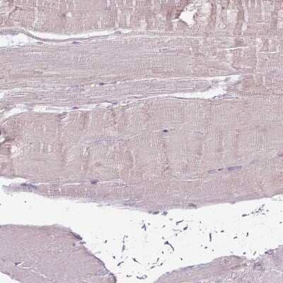 Immunohistochemistry-Paraffin: CCDC109B Antibody [NBP2-14657]