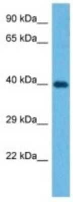 Western Blot: CCDC109B Antibody [NBP3-10846]