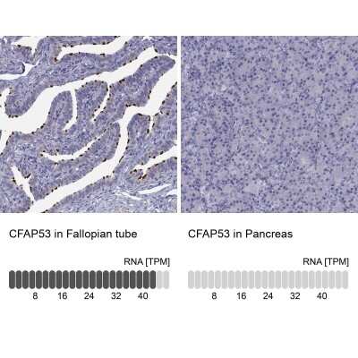 Immunohistochemistry-Paraffin: CCDC11 Antibody [NBP2-62649]