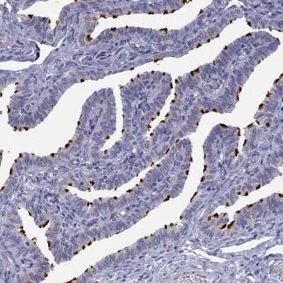 Immunohistochemistry-Paraffin: CCDC11 Antibody [NBP2-62649]