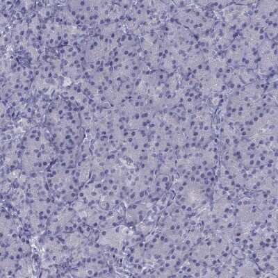 Immunohistochemistry-Paraffin: CCDC11 Antibody [NBP2-62649]