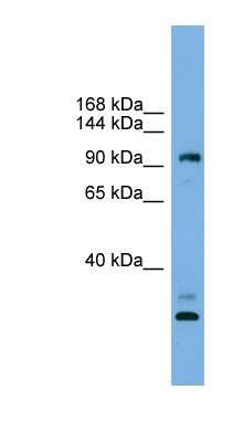 Western Blot: CCDC110 Antibody [NBP1-79593]