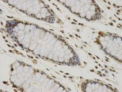 Immunohistochemistry-Paraffin: CCDC111 Antibody (10-B3) [NBP2-67217]