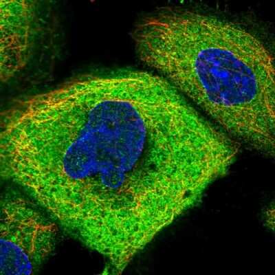 Immunocytochemistry/ Immunofluorescence: CCDC112 Antibody [NBP2-48610]