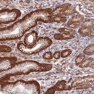 Immunohistochemistry-Paraffin: CCDC112 Antibody [NBP2-14442]