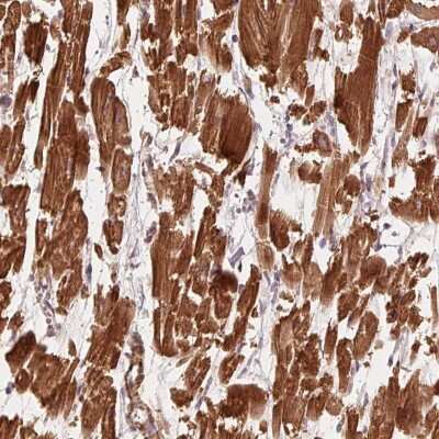 Immunohistochemistry-Paraffin: CCDC112 Antibody [NBP2-48610]