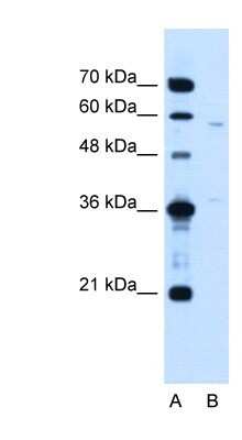 Western Blot: CCDC112 Antibody [NBP1-59468]