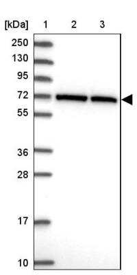 Western Blot: CCDC112 Antibody [NBP2-14442]