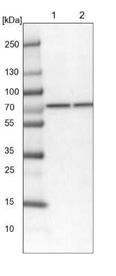 Western Blot: CCDC112 Antibody [NBP2-14442]