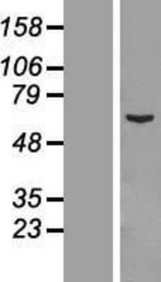 Western Blot: CCDC112 Overexpression Lysate [NBL1-08768]