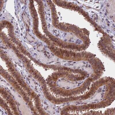 Immunohistochemistry-Paraffin: CCDC113 Antibody [NBP2-14444]